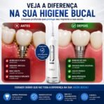 ⁦جهاز JETFLOSS المحمول لتنظيف الأسنان بالماء – خيط مائي لاسلكي⁩ - الصورة ⁦4⁩